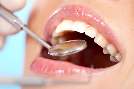 ワイズ板橋歯科・おとなこども矯正歯科の歯周病治療