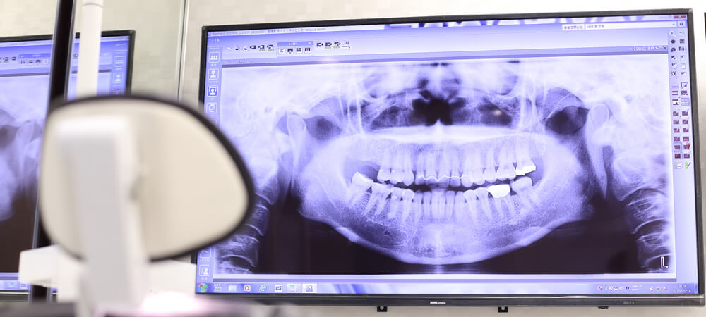 ワイズ板橋歯科・おとなこども矯正歯科の根管治療