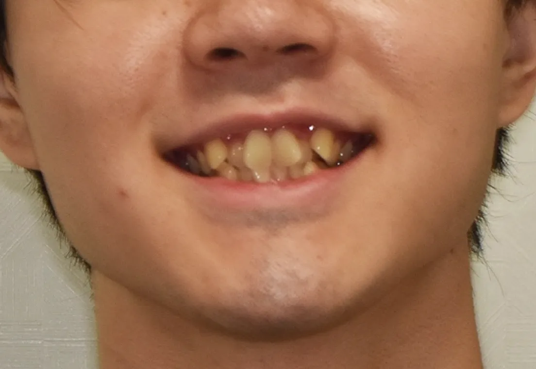 Before