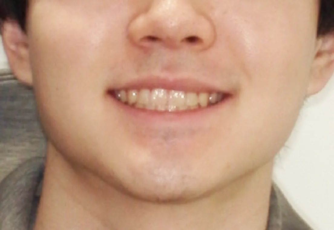 After